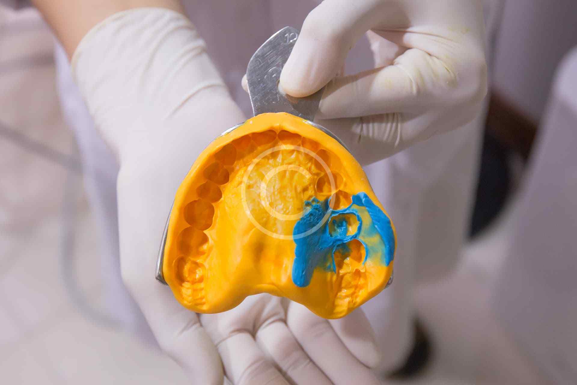 Bite molding